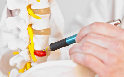 La hernia discal, un mal que hay que prevenir con prudencia